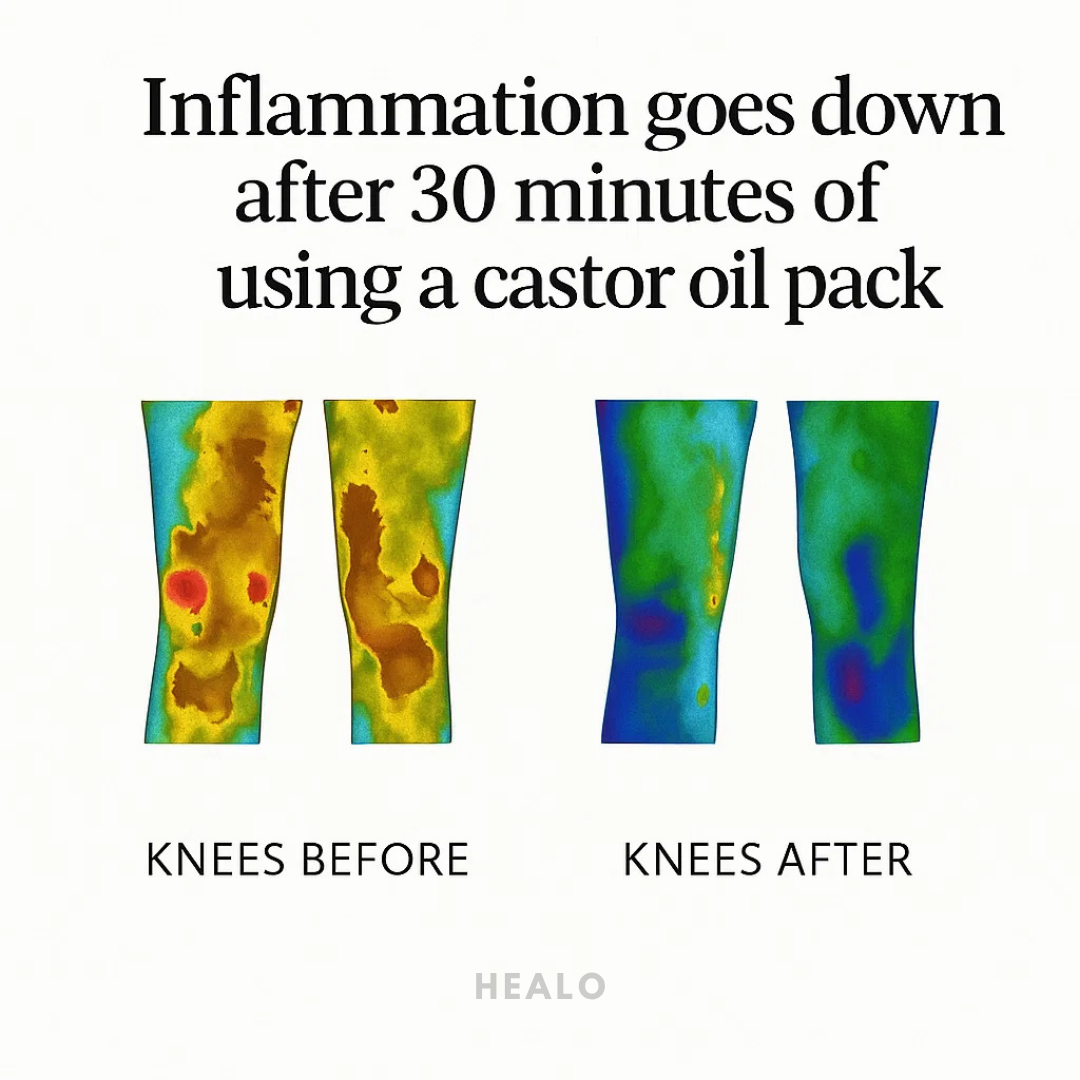 Healo Premium Wellness Pack